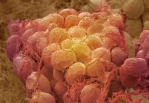 Наслідки ожиріння: Чому так складно зберегти втрачену вагу