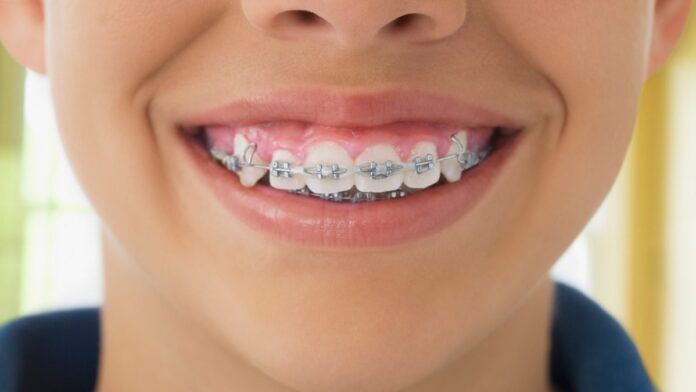 d91dbf39-46e5-486e-81cd-698a5deae4de